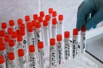 УЧЕНЫЕ НАШЛИ ПРЕВОСХОДЯЩЕЕ ЛЕКАРСТВА НАТУРАЛЬНОЕ СРЕДСТВО ОТ COVID-19